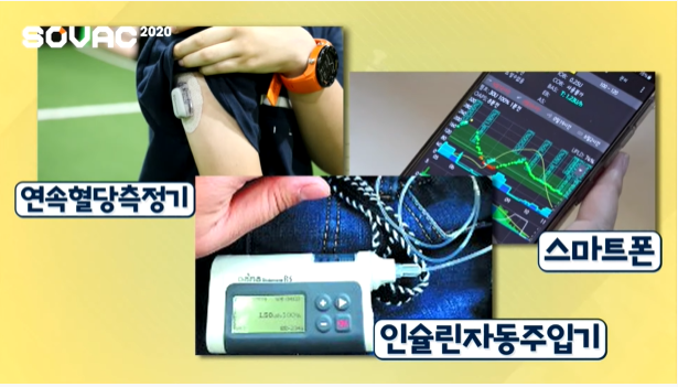 김미영 씨는 연속혈당측정기로부터 실시간으로 정보를 받아 환자의 상태를 확인할 수 있는 앱을 개발했다. /사진=SOVAC 유뷰트 갈무리